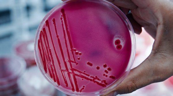FDA probes salmonella outbreak as 84 fall ill, source unknown