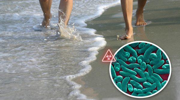 Flesh-eating bacteria kills 10 in Florida and Louisiana as officials warn of risks