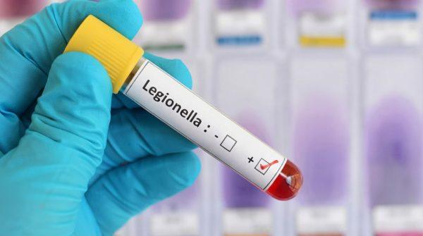 Legionnaires' outbreak in the Bronx: who's at risk and what to watch for